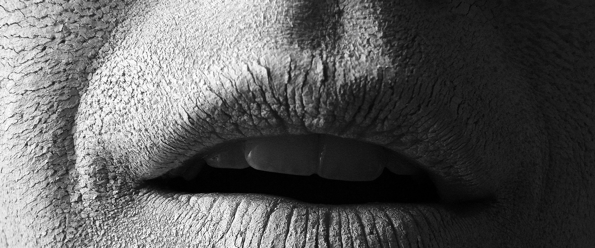 Why is my mouth always dry? SF Dental