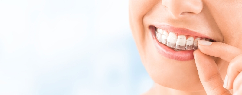 Woman adjusting invisalign aligner