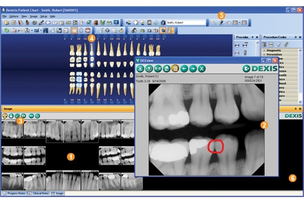 digital xray software