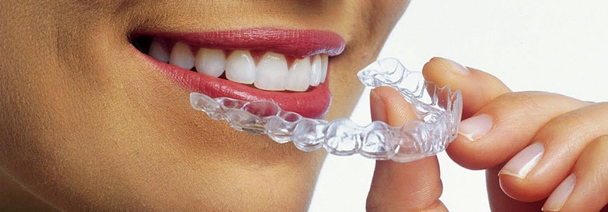 Woman removing invisalign retainer