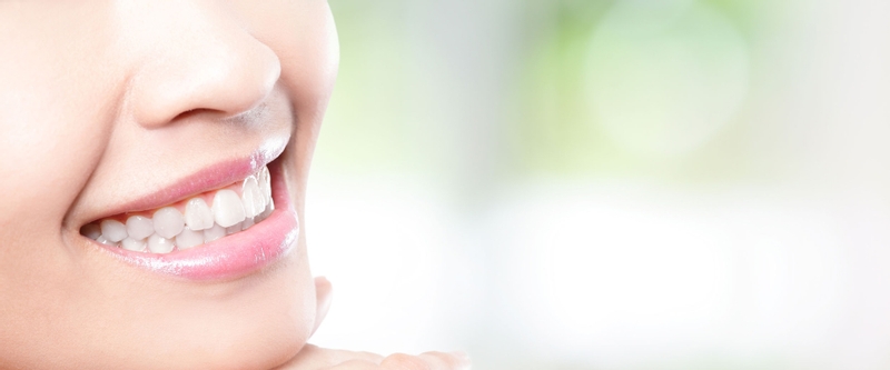 close-up of a smiling woman's teeth