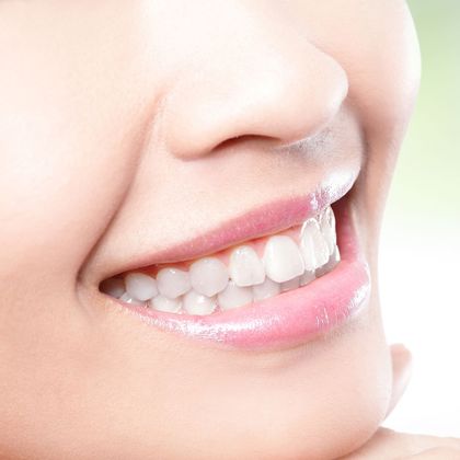 close-up of a smiling woman's teeth